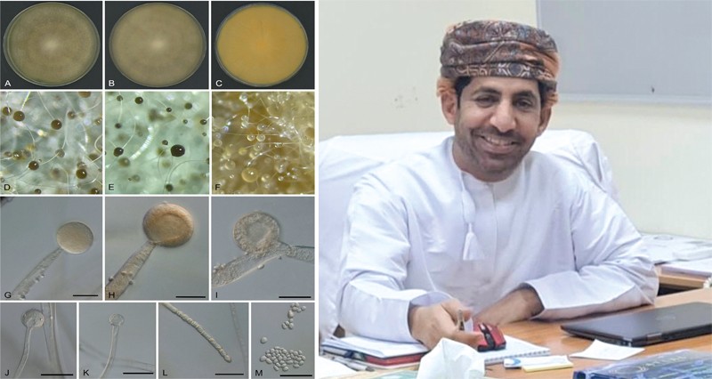 &laquo;جامعةنزوى&raquo; تكتشف فطر طبي ثنائي الشكل لأول مرة على مستوى العالم