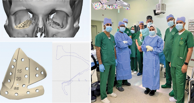 الأولى من نوعها فـي سلطنة عمان ..  إجراء عملية جراحية لإعادة بناء كسر أرضية حجاج العين